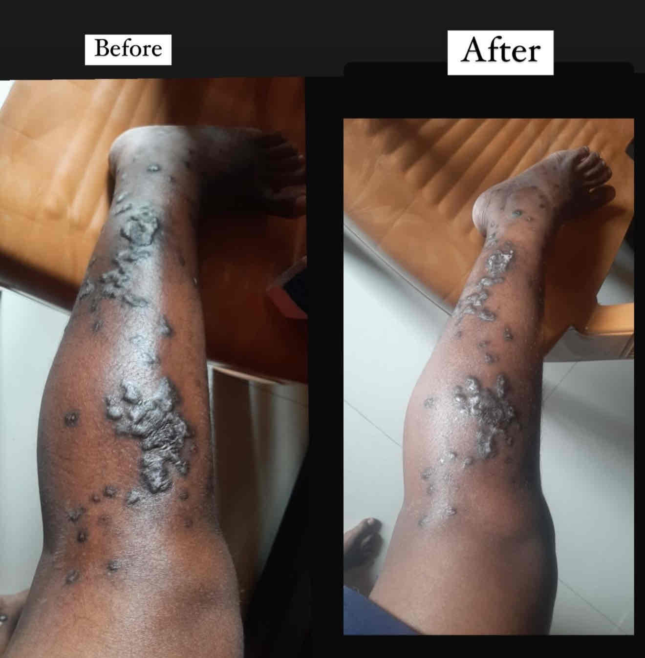 Expertise in Weight Management Professional, Fitness Nutritionist