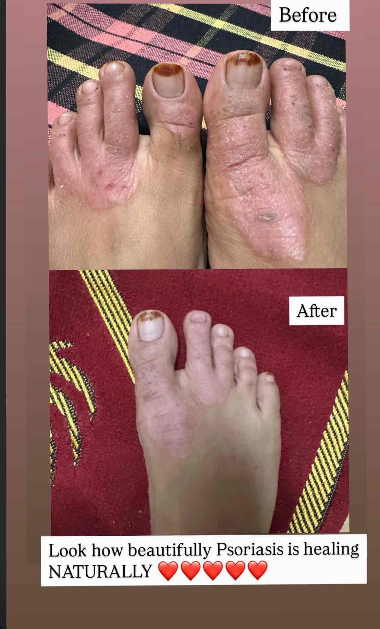 Expertise in Weight Management Professional, Fitness Nutritionist