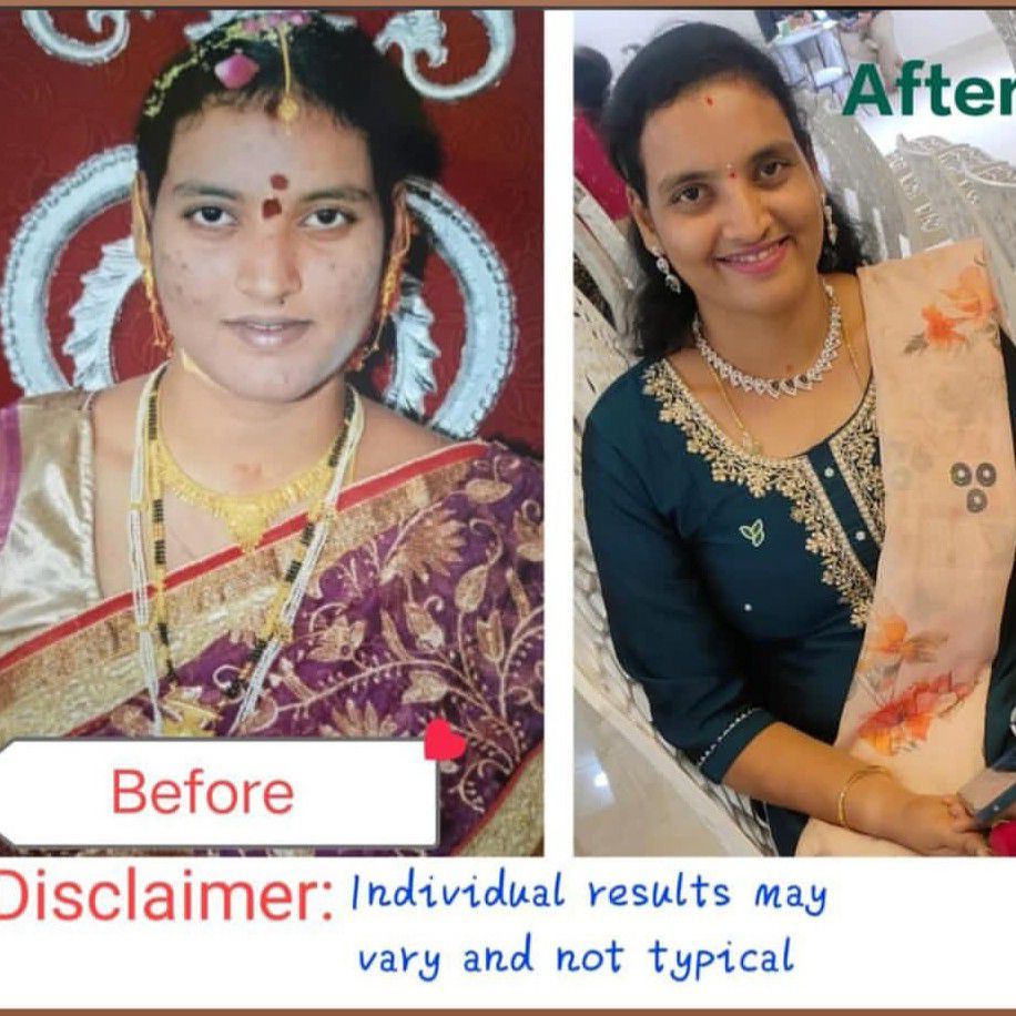 Expertise in Nutrition & Diet